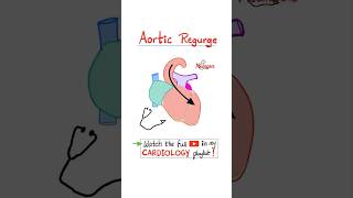 Aortic Regurgitation AR  Valvular Heart Disease VHD…biology science cardiology anatomy [upl. by Merlin]