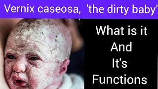 Whats vernix caseosa what is its benefits [upl. by Aiz]