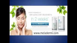 Meladerm Cream Reviews  My Experience Facts On Meladerm [upl. by Initsed]