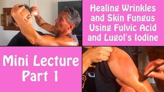 Healing Wrinkles and Skin Fungus Using Fulvic Acid and Lugols Iodine Part 1  Dr Robert Cassar [upl. by Shaefer961]