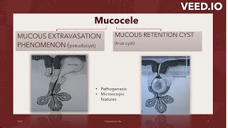 MUCOCELEMUCOUS EXTRAVASATIONSUPERFICIAL MUCOCELE imagebasedquestion bdshorts neetmds2023 [upl. by Clite]