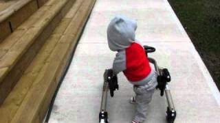 Jakob Walking with walker arthrogryposis [upl. by Mauldon101]