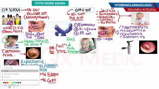 Otorrinolaringología  OMA [upl. by D'Arcy659]