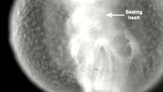 Heartbeat movie of an E85 mouse embryo after 12 h of WEC [upl. by Fatma]