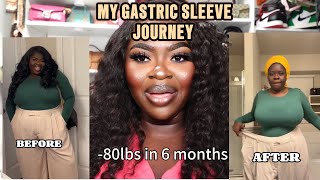 MY GASTRIC SLEEVE JOURNEY [upl. by Jerrylee]