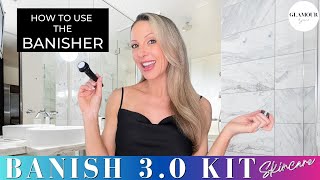 Banish 30 Kit Review  The at Home Microneedling Everyones Talking About  DISCOUNT CODE [upl. by Elder]