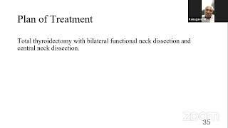 PG CLINICS CARCINOMA THYROID [upl. by Lehrer]