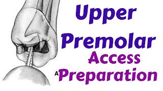 Upper Maxillary Premolars  Endodontic Access cavity Preparation Endodontic Lecture amp Tutorial [upl. by Melantha]