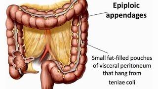 Epiploic Appendagitis Everything You Need To Know epiploicappendagitis autoimmunewarrior Gipain [upl. by Eelyek]