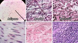 Identifying Connective Tissue  Review and Practice [upl. by Bertilla974]