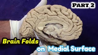 NeuroAnatomy  Brain Folds  Sulci and Gyri on Medial Surface of the BrainAnatomy Dissection Part 2 [upl. by Lougheed]