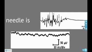 EMG and Action Potentials [upl. by Eelamme]