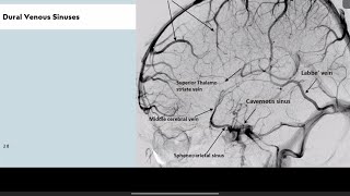 MASTERING ANGIOGRAMS FOR FRCR 1PART 4 [upl. by Walker496]