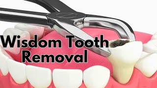 Wisdom Teeth Removal  Tooth Extraction  Wisdom teeth removel recovery Process [upl. by Aketal888]