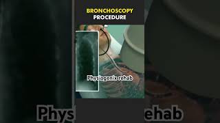 Bronchoscopy procedure shortsviral youtubeshort shortsfeed shortsyoutube youtubevideo youtuber [upl. by Leira]