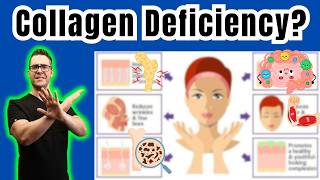 8 Signs amp Symptoms of A Collagen Deficiency [upl. by Hewe]