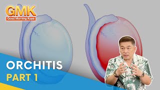 Orchitis What Is It Causes Symptoms and Treatment Part 1  Usapang Pangkalusugan [upl. by Magda]