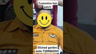 Customize hair patch hairst hairpatchindelhi hairaccessory hairwigservicesindelhi hairextension [upl. by Arretal]