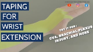 Taping to Facilitate Wrist Extension  Great for Brachial Plexus Injuries such as Erbs Palsy [upl. by Saffier]