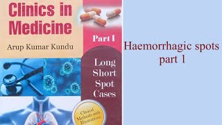 Haemorrhagic Spots part 1 [upl. by Anivahs]