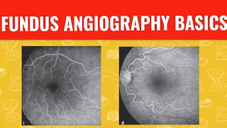 FFA course  FUNDUS FLUORESCEIN ANGIOGRAPHY [upl. by Aved387]