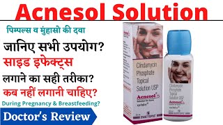 Acnesol Solution  Acnesol solution how to use  Acnesol solution for acne [upl. by Ahseinek132]