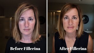 Fillerina Plumping System Review  BEFORE and AFTER [upl. by Mini416]