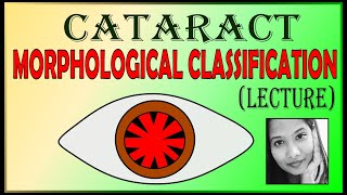 Morphological Classification of Cataract  Different Types of Cataract  Ophthalmology Lectures [upl. by Siddra]