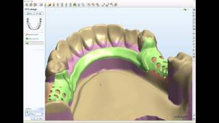 3Shape Removable Partial Framework Design 2  NEW 2010  CadBluDentalcom [upl. by Adniroc316]