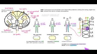 Spinal cord lesions Spinothalamic tract UMN and LMN BrownSequard As easy as it gets [upl. by Evers]