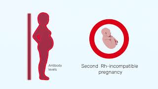 How Rh factor affects a pregnancy [upl. by Nattirb112]