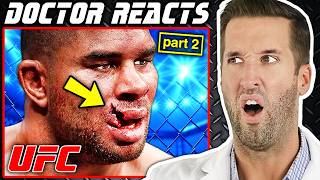 ER Doctor REACTS to Worst MMA Injuries in UFC History 2 [upl. by Ococ]