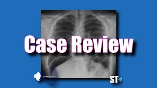 Case Review  Pneumoperitoneum [upl. by Dnomra]