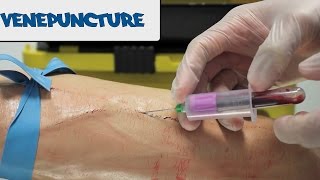 Venipuncture  How to take Blood  OSCE Guide old version  UKMLA  CPSA [upl. by Ahsener]