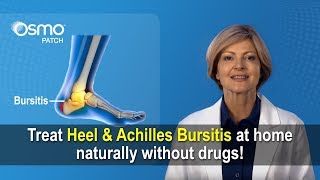 Achilles Bursitis  Retrocalcaneal bursitis Heel bursitis treatment [upl. by Marron]