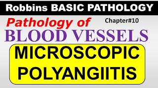 Ch10  MICROSCOPIC POLYANGIITIS  Blood Vessel Pathology  Robbins Lectures [upl. by Sanferd123]