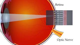 How does an artificial retina work [upl. by Eizeerb]