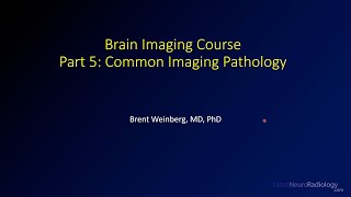 Brain imaging course – 5 – Common imaging pathology [upl. by Kifar322]