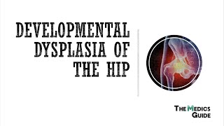 Developmental Dysplasia Of The Hip  A Clinical Overview for Medical Students [upl. by Monika535]