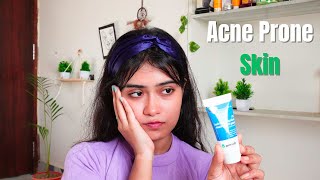 Derma Co 1 Salicylic Acid Gel Facewash Honest Review [upl. by Laet]