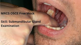 MRCS OSCE Free Mock  Skill Submandibular Gland Examination [upl. by Tellford]