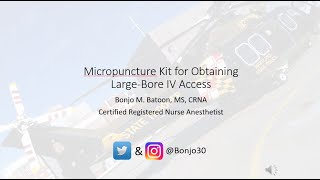 Micropuncture kit for largebore venous access [upl. by Somisareg]