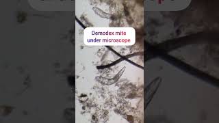 mite under microscope mite canine demodicosis [upl. by Ponce]