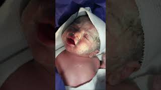 My newborn baby with Vernix Caseosa Just after birth cutebabyboy baby babyborn newbornbaby [upl. by Vastah]