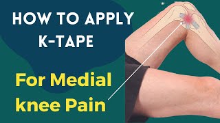 How to treat Knee Pain  Medial Collateral Ligament MCL  Kinesiology taping [upl. by Airehc248]