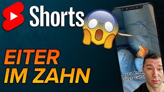 Zyste am Zahn shorts [upl. by Amalberga]