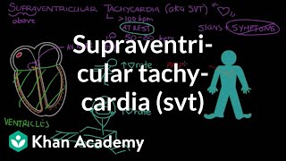 Supraventricular tachycardia SVT  Circulatory System and Disease  NCLEXRN  Khan Academy [upl. by Penelope]