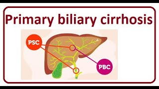 Primary Biliary Cirrhosis  2024 [upl. by Alyak]