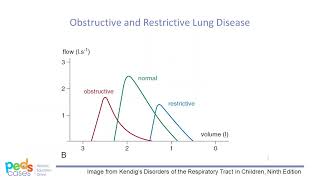 Approach to Spirometry [upl. by Mufi]