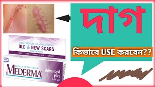 Mederma  Mederma Advanced Plus Scar Gel  Mederma Advanced Plus Scar Gel In Bengali [upl. by Fisa]